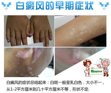 怎么样能变白点 5077a7a4d687b0c80b74f66d3fce42c8.jpg