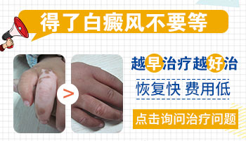 白癜风的颜色都是怎样的