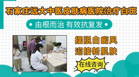 石家庄看白斑去哪个医院靠谱
