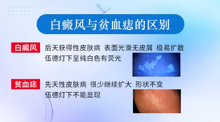 白斑怎么看是哪种皮肤病
