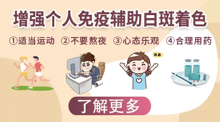 石家庄进口芦可替尼外用治疗白斑医院