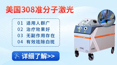 308激光治疗白癜风多久能停止光疗