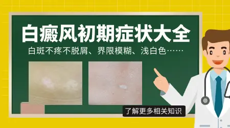 白癜风ZUI初有哪些征兆图片