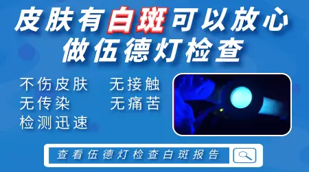 不同医院的伍德灯检查结果不一样正常吗