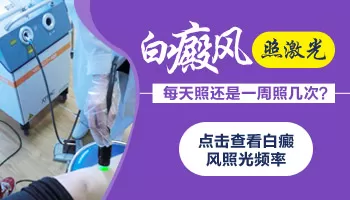 白癜风照激光每天照好还是一周三次好