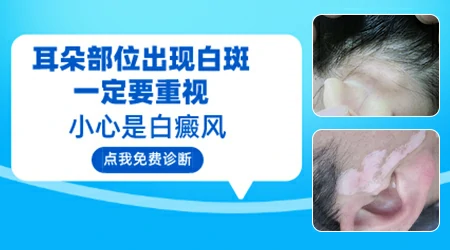 耳朵前面皮肤白了一块是因为什么