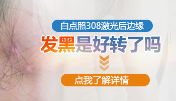 白斑照完308激光后边缘变大怎么回事