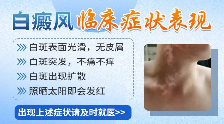 白癜风ZUI初期的症状图片 能不能治好