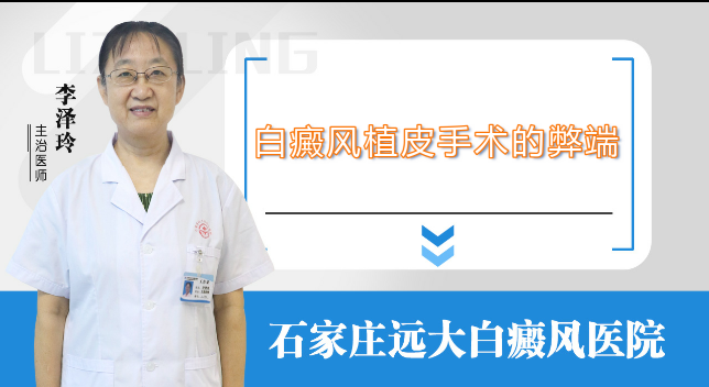 白癜风植皮手术的弊端