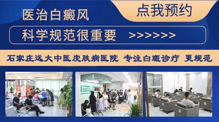 补骨脂和酒精一起泡能治白斑吗