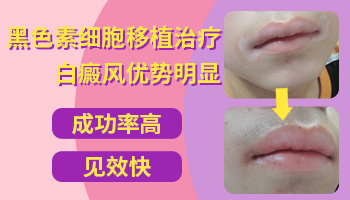 白斑黑色素细胞移植手术大概得多少钱