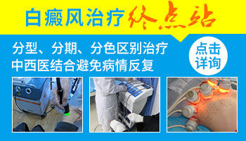 肚子两侧白癜风半年了怎么治