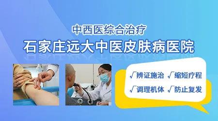 中医中药能彻底治好白癜风吗