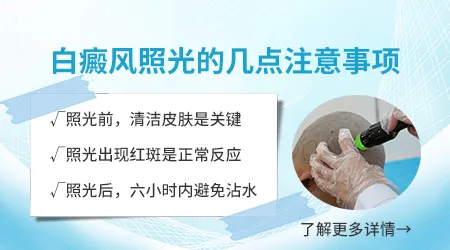白癜风光疗剂量越大效果越好吗