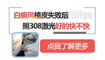 白癜风植皮手术后效果不大怎么回事