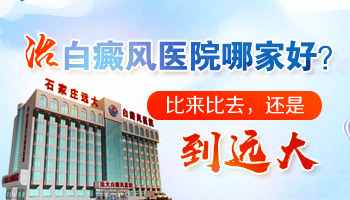 身上有白癜风但是怀孕4个月了能激光吗