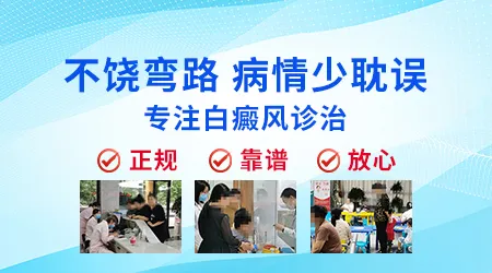 白癜风出现同形反应该怎么办