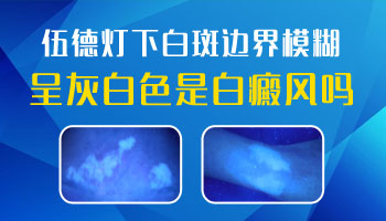 伍德灯检查白斑颜色对照图