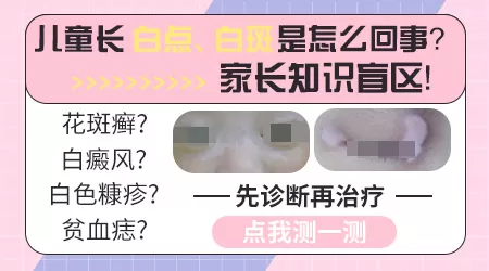 小孩腿上有白斑怎么回事