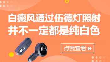 伍德灯检查白斑有弱荧光