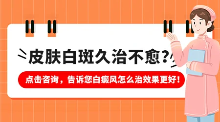 白癜风用什么药能快速消除