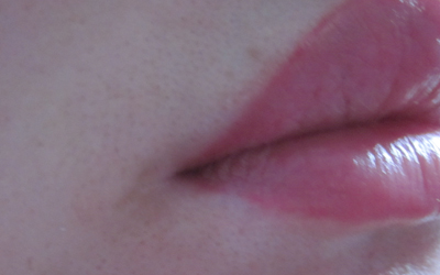 嘴唇上有白白的斑点是什么