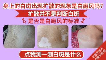 长在下嘴唇周围的白斑突然扩大怎么回事