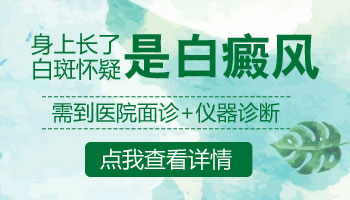 怀疑身上白点是白癜风怎么确定