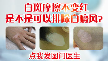 白癜风用力摩擦会有什么反应