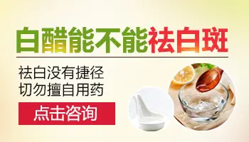 白醋对治疗白癜风有效吗