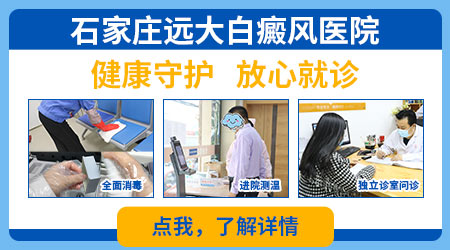 患有白癜风如何进行抗复发治疗