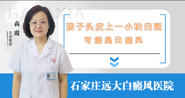 孩子头皮上一小块白斑可能是白癜风