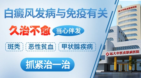 白癜风是自身免疫性疾病吗