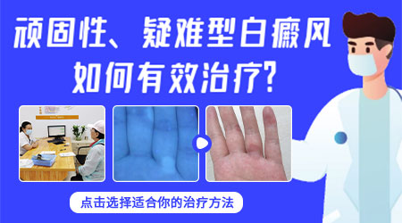 儿童白癜风在手上能治好吗