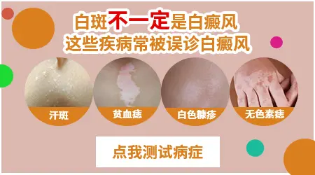 白斑是白癜风吗 如何区分