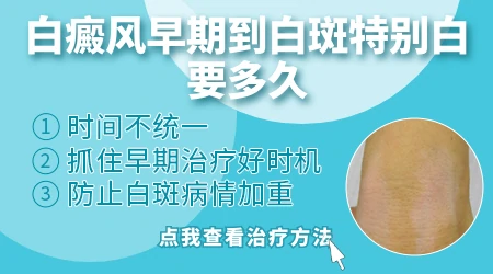 白癜风怎么治疗见效快恢复率高