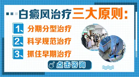 晕痣和普通白癜风有什么区别