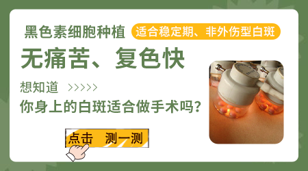 白癜风初期适合手术治疗吗