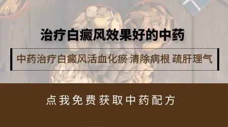 中药调理白癜风有用吗 根治白斑几率多大