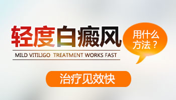 轻度白癜风需不需要长期吃药