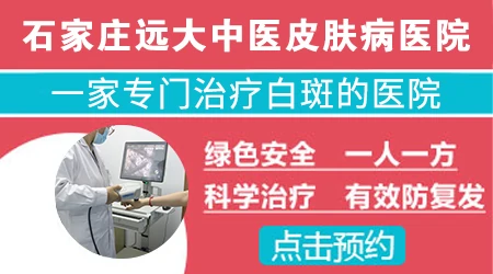 石家庄专门治疗皮肤白斑医院