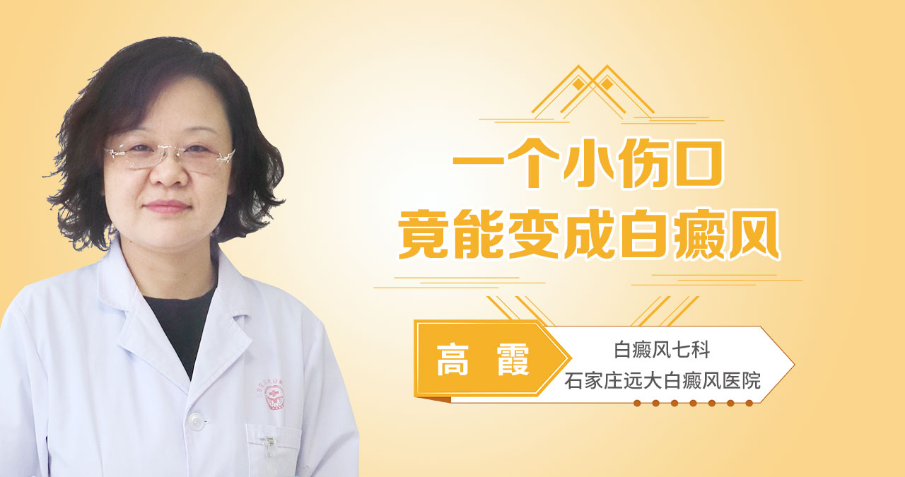 一个小伤口竟能变成白癜风