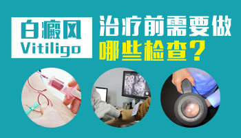 除了白癜风什么原因会引起皮肤一块白