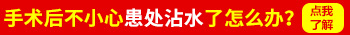 白癜风做了黑色素细胞移植手术后多久可以碰水