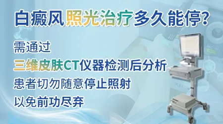 白癜风光疗到什么程度可以停止