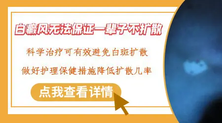 刚发现的白斑多久会扩散成大面积