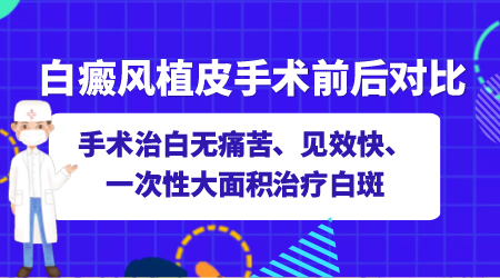 白癜风面部植皮手术图