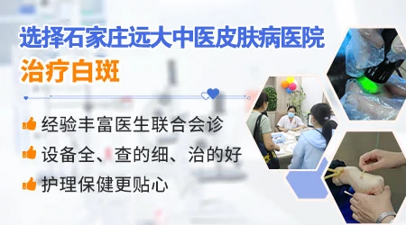 石家庄看白癜风ZUI好的医院是哪家