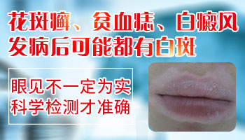 嘴唇周围上有白色斑块是什么