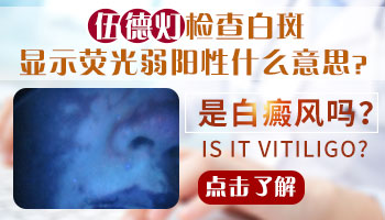 伍德灯下白点显示弱阳性怎么回事